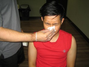 Managing a bleeding nose